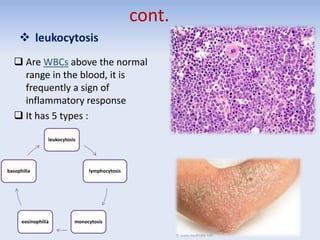cont.
 leukocytosis
 Are WBCs above the normal
range in the blood, it is
frequently a sign of
inflammatory response
 It has 5 types :
leukocytosis
lymphocytosis
monocytosiseosinophilia
basophilia
 