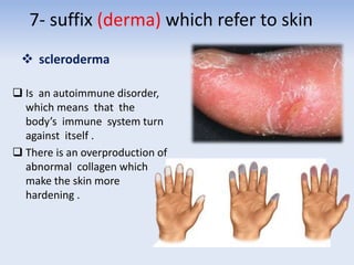 7- suffix (derma) which refer to skin
 scleroderma
 Is an autoimmune disorder,
which means that the
body’s immune system turn
against itself .
 There is an overproduction of
abnormal collagen which
make the skin more
hardening .
 