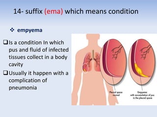 14- suffix (ema) which means condition
 empyema
Is a condition In which
pus and fluid of infected
tissues collect in a body
cavity
Usually it happen with a
complication of
pneumonia
 