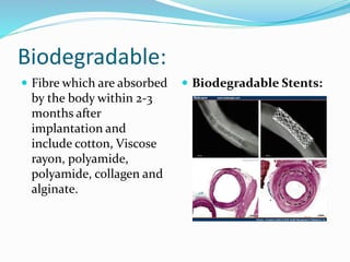Medical textile | PPTX