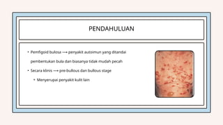 Comprehensive Overview of Bullous Pemphigoid: Pathophysiology ...