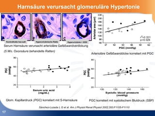 Harnsäure verursacht glomeruläre Hypertonie




     Kontrollratte low-salt   Hyperuricämische Ratte    Hyperuricämie + XOH

Serum Harnsäure verursacht arterioläre Gefäßwandverdickung
(5 Wo. Oxonsäure behandelte Ratten)
                                                                               Arterioläre Gefäßwanddicke korreliert mit PGC




     Glom. Kapillardruck (PGC) korreliert mit S-Harnsäure                     PGC korreliert mit systolischem Blutdruck (SBP)

                                 Sánchez-Lozada L G et al. Am J Physiol Renal Physiol 2002;283:F1105-F1110
17
 