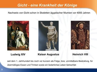 Gicht - eine Krankheit der Könige
    Nachweis von Gicht schon in Skeletten ägyptischer Mumien vor 4000 Jahren




       Ludwig XIV                  Kaiser Augustus                     Heinrich VIII

    seit dem 1. Jahrhundert bis noch vor kurzem als Folge, bzw. unmittelbare Bestrafung, für
    übermäßiges Essen und Trinken sowie ein liederliches Leben betrachtet

3
 