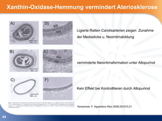 Xanthin-Oxidase-Hemmung vermindert Ateriosklerose


                           Ligierte Ratten Carotisarterien zeigen Zunahme
                           der Mediadicke u. Neointimabildung




                           verminderte Neointimaformation unter Allopurinol




                           Kein Effekt bei Kontrolliteren durch Allopurinol



                           Yamamoto Y Hypertens Res 2006;29:915-21


44
 