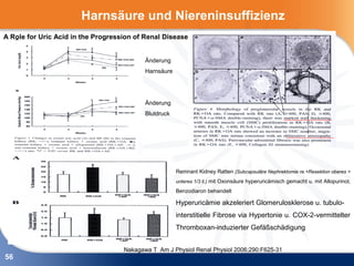 Harnsäure und Niereninsuffizienz
A Role for Uric Acid in the Progression of Renal Disease


                                           Änderung
                                           Harnsäure




                                           Änderung
                                           Blutdruck




                                                       Remnant Kidney Ratten (Subcapsuläre Nephrektomie re.+Resektion oberes +
                                                       unteres 1/3 li.) mit Oxonsäure hyperuricämisch gemacht u. mit Allopurinol,
                                                       Benzodiaron behandelt

                                                       Hyperuricämie akzeleriert Glomerulosklerose u. tubulo-
                                                       interstitielle Fibrose via Hypertonie u. COX-2-vermittelter
                                                       Thromboxan-induzierter Gefäßschädigung


                                    Nakagawa T Am J Physiol Renal Physiol 2006;290:F625-31
56
 