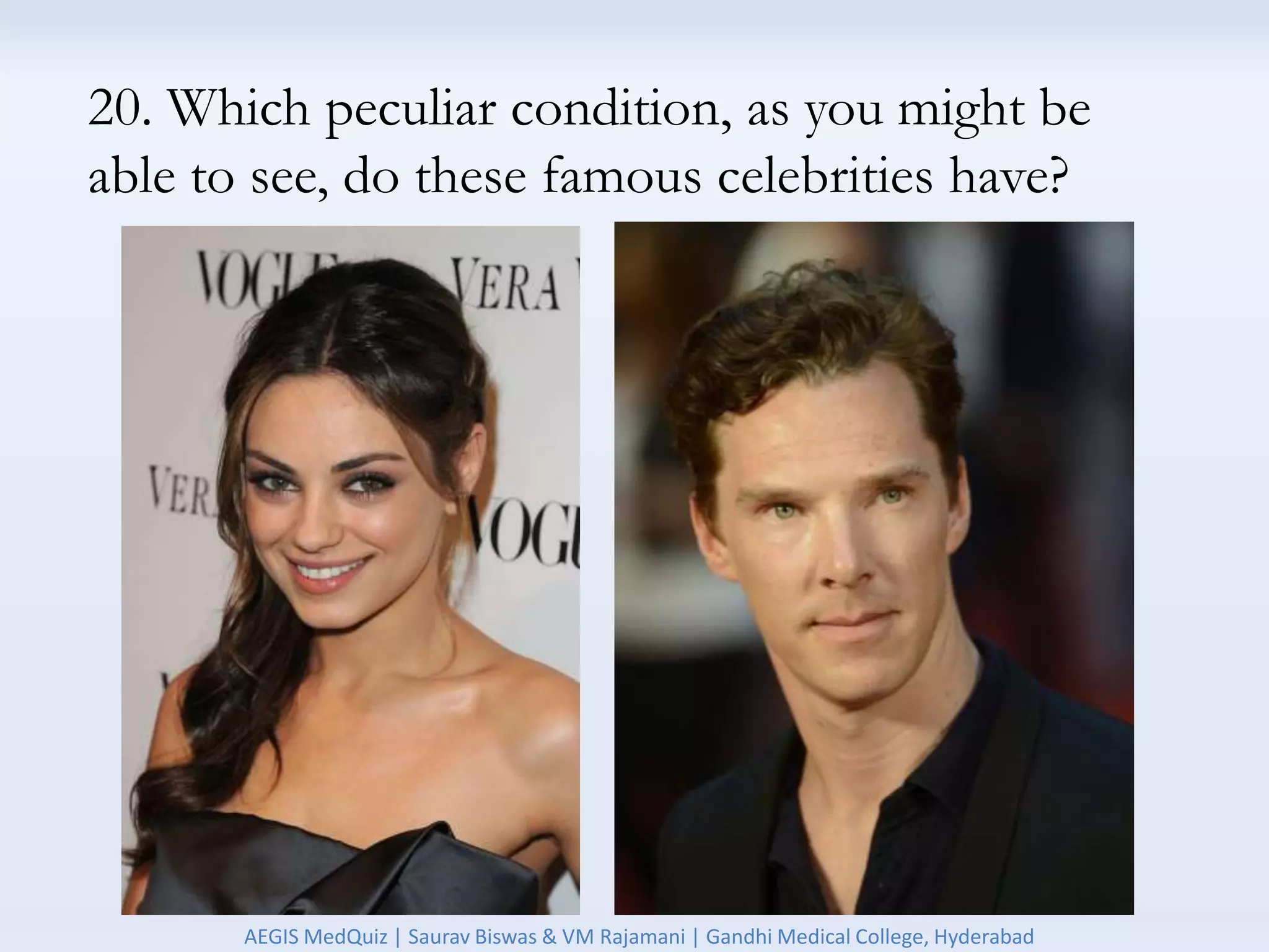 20. Which peculiar condition, as you might be
able to see, do these famous celebrities have?
AEGIS MedQuiz | Saurav Biswas & VM Rajamani | Gandhi Medical College, Hyderabad
 