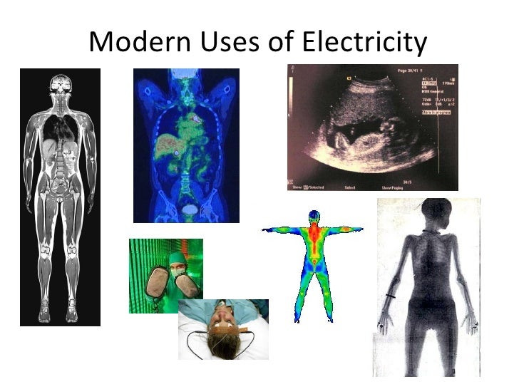 Medical Uses Of Electricity