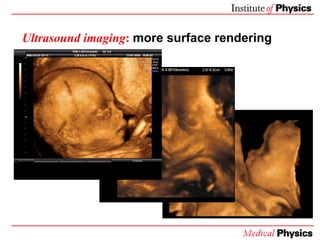 Medical Uses Of Ultrasound