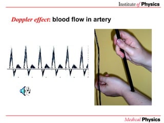 Doppler effect :   blood flow in artery 