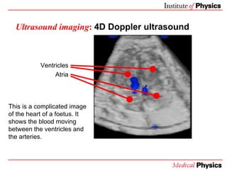 Ultrasound imaging :   4D Doppler ultrasound <ul><li>Ventricles </li></ul><ul><li>Atria </li></ul>This is a complicated im...