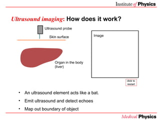 Ultrasound imaging :   How does it work? <ul><li>An ultrasound element acts like a bat. </li></ul><ul><li>Emit ultrasound ...