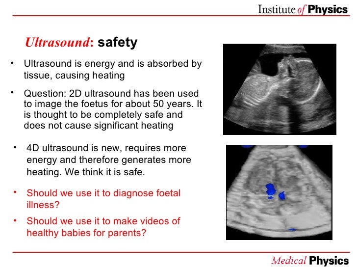 Medical Uses Of Ultrasound