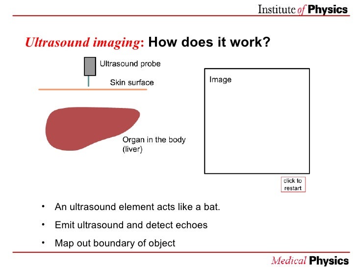 medical uses of ultrasound how ultrasound imaging works
