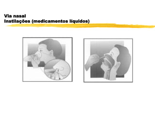 Via nasal
Instilações (medicamentos líquidos)
 