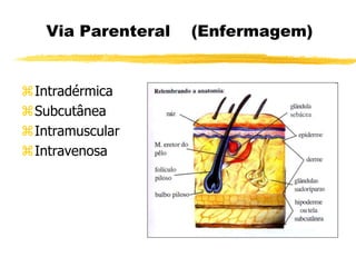 Via Parenteral (Enfermagem)
Intradérmica
Subcutânea
Intramuscular
Intravenosa
 