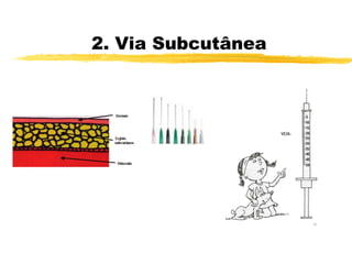 2. Via Subcutânea
 