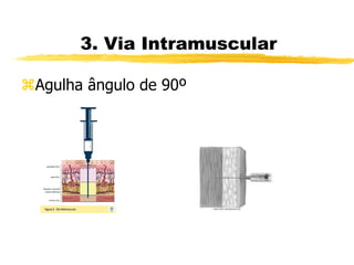 3. Via Intramuscular
Agulha ângulo de 90º
 