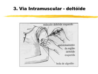 3. Via Intramuscular - deltóide
 