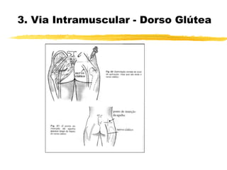 3. Via Intramuscular - Dorso Glútea
 
