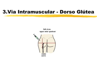 3.Via Intramuscular - Dorso Glútea
 