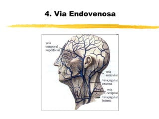 4. Via Endovenosa
 