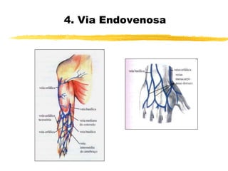 4. Via Endovenosa
 