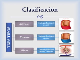 
TRESTIPOS
Arteriales Efecto predominante
arterial
Venosos Efecto predominante
venoso
Mixtos Efecto equilibrado
(arterial y venoso)
Clasificación
 
