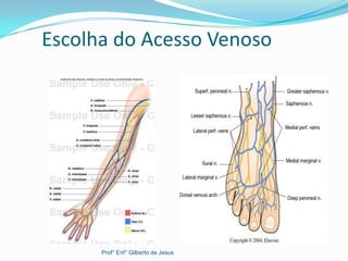 Escolha do Acesso Venoso
Prof° Enf° Gilberto de Jesus
 