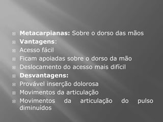  Metacarpianas: Sobre o dorso das mãos
 Vantagens:
 Acesso fácil
 Ficam apoiadas sobre o dorso da mão
 Deslocamento do acesso mais difícil
 Desvantagens:
 Provável inserção dolorosa
 Movimentos da articulação
 Movimentos da articulação do pulso
diminuídos
 