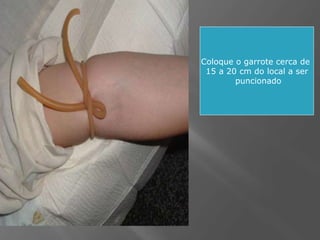 Coloque o garrote cerca de
15 a 20 cm do local a ser
puncionado
 