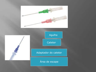 Adaptador do cateter
Área de escape
Cateter
Agulha
 