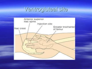 Ventrogluteal site
 
