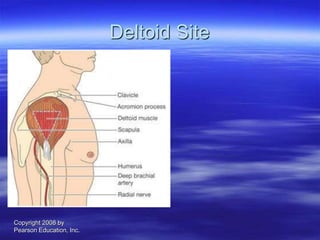 Copyright 2008 by
Pearson Education, Inc.
Deltoid Site
 