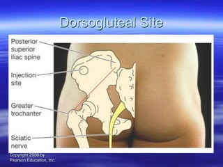 Copyright 2008 by
Pearson Education, Inc.
Dorsogluteal Site
 