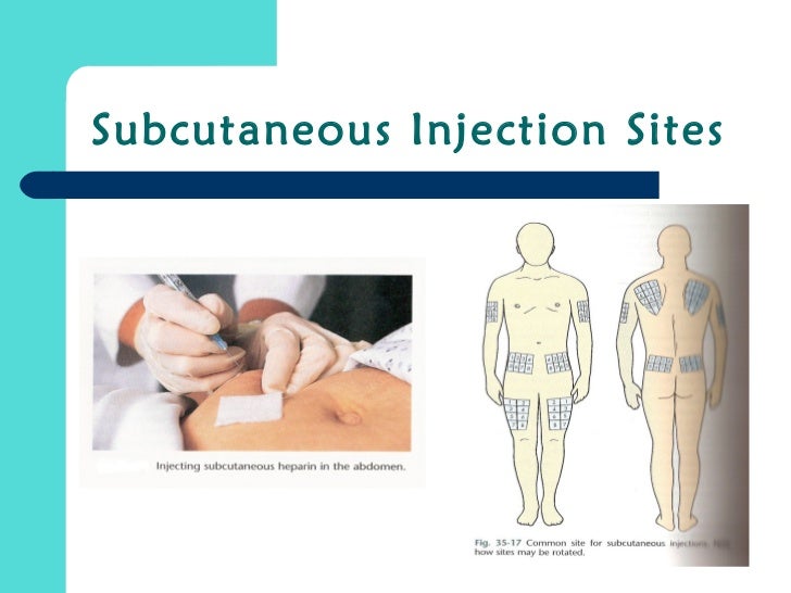 Administration of medication by injection