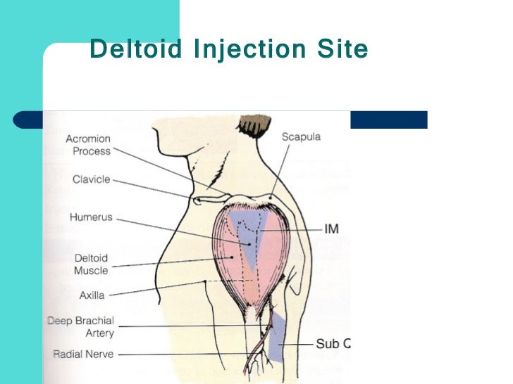 Administration of medication by injection