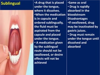 Sublabially Medication administration | PPTX