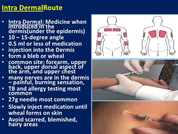 Administration of medication by injection