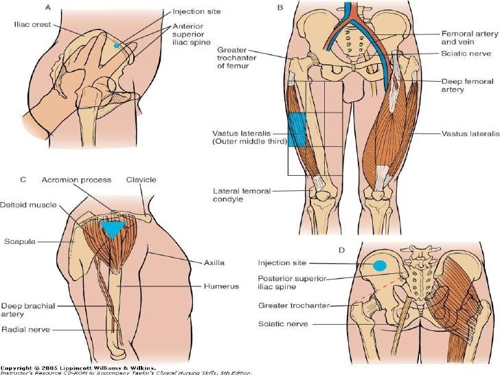 intramuscular injection sites