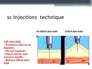 Tvec Injection Technique Comprehensive Guide to Safe Medication Administration and Injection ...