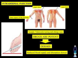 INTRADERMAL INJECTION
                                     Upper chest                        Upper back




     Inner aspect of the forearm




                               Sample: Tuberculin testing and allergy tests

                                    DRUGS ARE POTENT


                                                   DERMIS

                             Reduced blood supply and absorption slowed
 