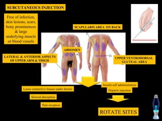 SUBCUTANEOUS INJECTION

 Free of infection,
skin lesions, scars,
bony prominences                                   SCAPULARIS AREA ON BACK
      & large
underlying muscle
 or blood vessels

                                          ABDOMEN

LATERAL & ANTERIOR ASPECTS                                                UPPER VENTRODORSAL
   OF UPPER ARM & THIGH                                                      GLUTEAL AREA




                                                                 Insulin self administration
           Loose connective tissues under dermis                     Heparin injection

                 Slowed absorption

                         Pain receptors

                                                               ROTATE SITES
 