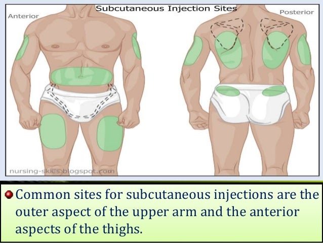 What are some common injection sites?