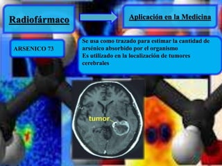 Radiofármaco Aplicación en la Medicina 
ARSENICO 73 
Se usa como trazado para estimar la cantidad de 
arsénico absorbido por el organismo 
Es utilizado en la localización de tumores 
cerebrales 
 