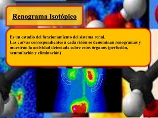 Renograma Isotópico 
Es un estudio del funcionamiento del sistema renal. 
Las curvas correspondientes a cada riñón se denominan renogramas y 
muestran la actividad detectada sobre estos órganos (perfusión, 
acumulación y eliminación) 
 