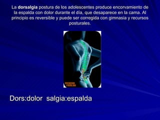 La  dorsalgia  postura de los adolescentes produce encorvamiento de la espalda con dolor durante el día, que desaparece en la cama. Al principio es reversible y puede ser corregida con gimnasia y recursos posturales. Dors:dolor  salgia:espalda  