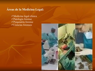 Áreas de la Medicina Legal: Medicina legal clínica  Patología forense Psiquiatría forense Ciencias forenses 