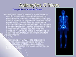 Aplicações Clínicas Ortopedia – Varredura Óssea A cintilografia óssea é realizada injetando-se na veia do paciente um traçador radioativo ou radiofármaco, marcado com tecnécio-99m que, quando injetado no organismo, acumula-se no tecido ósseo. A substância se acumula em áreas de alta atividade metabólica, e a imagem produzida mostra os "pontos brilhantes" de alta atividade e os "pontos escuros" de baixa atividade. A varredura óssea é vantajosa para detecção de tumores, que normalmente têm alta atividade  As varreduras por (SPECT) são capazes de detectar pequenas anomalias cerebrais, responsáveis por ataques epilépticos, e detectar constrições em vasos sangüíneos ou tumores ocultos.  