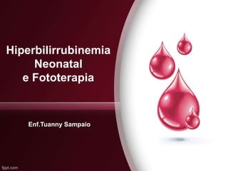 Hiperbilirrubinemia
Neonatal
e Fototerapia
Enf.Tuanny Sampaio
 