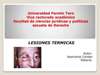 Universidad Fermín Toro
Vice rectorado académico
facultad de ciencias jurídicas y políticas
escuela de Derecho
LESIONES TERMICAS
Autor:
Jeancarlos Corobo
Materia:
 